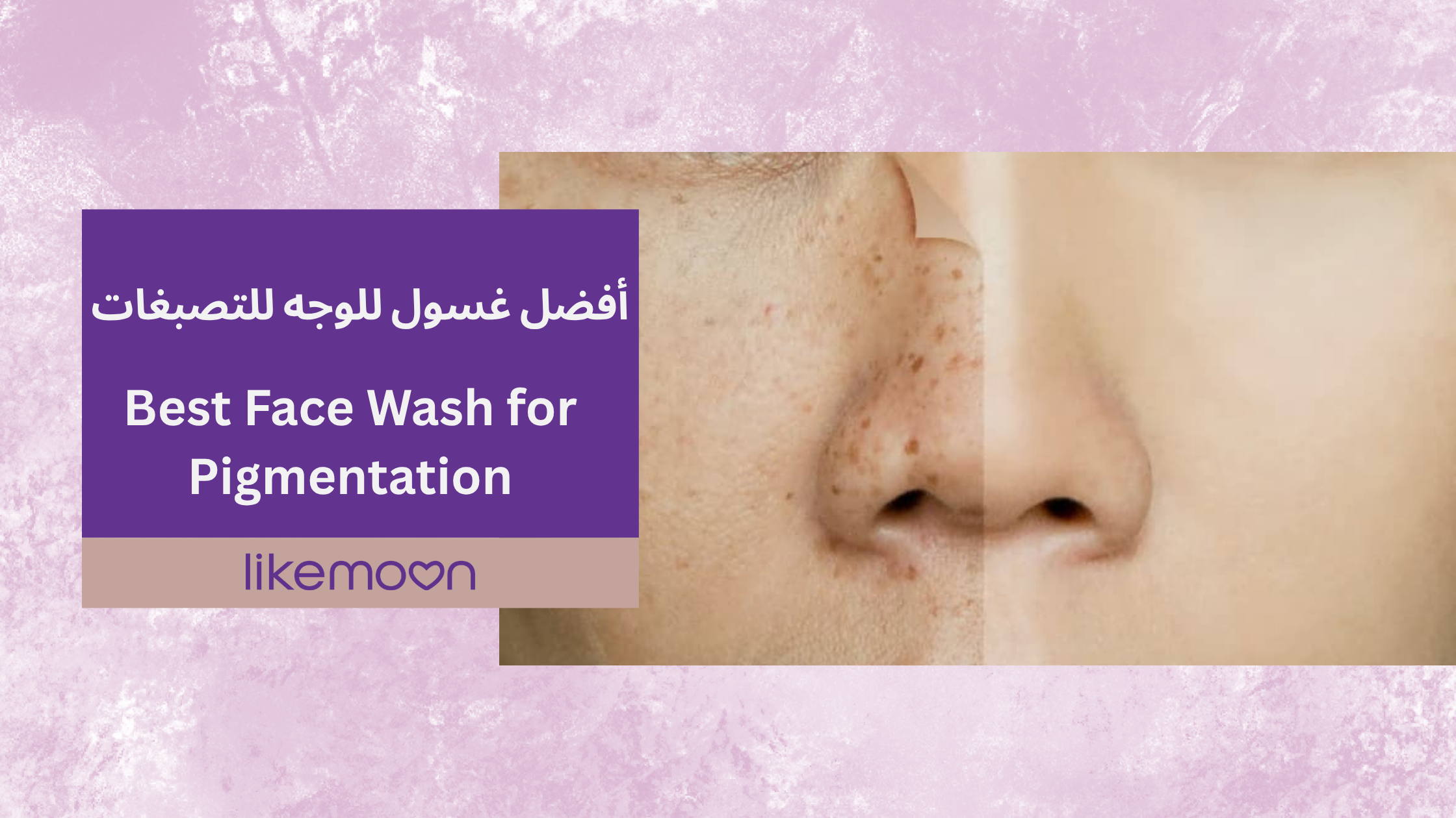 Best Face Wash for Pigmentation
